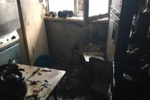 В Туле из-за пожара на кухне пострадал человек.